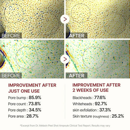 Rice Peel Glow Serum Ampoule